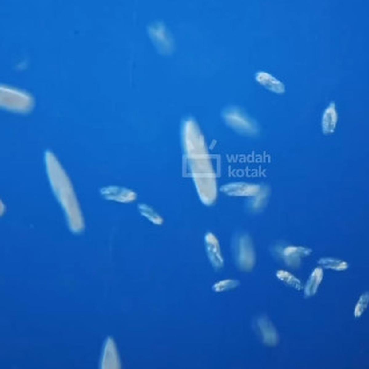 Bakteri di Air Kolam