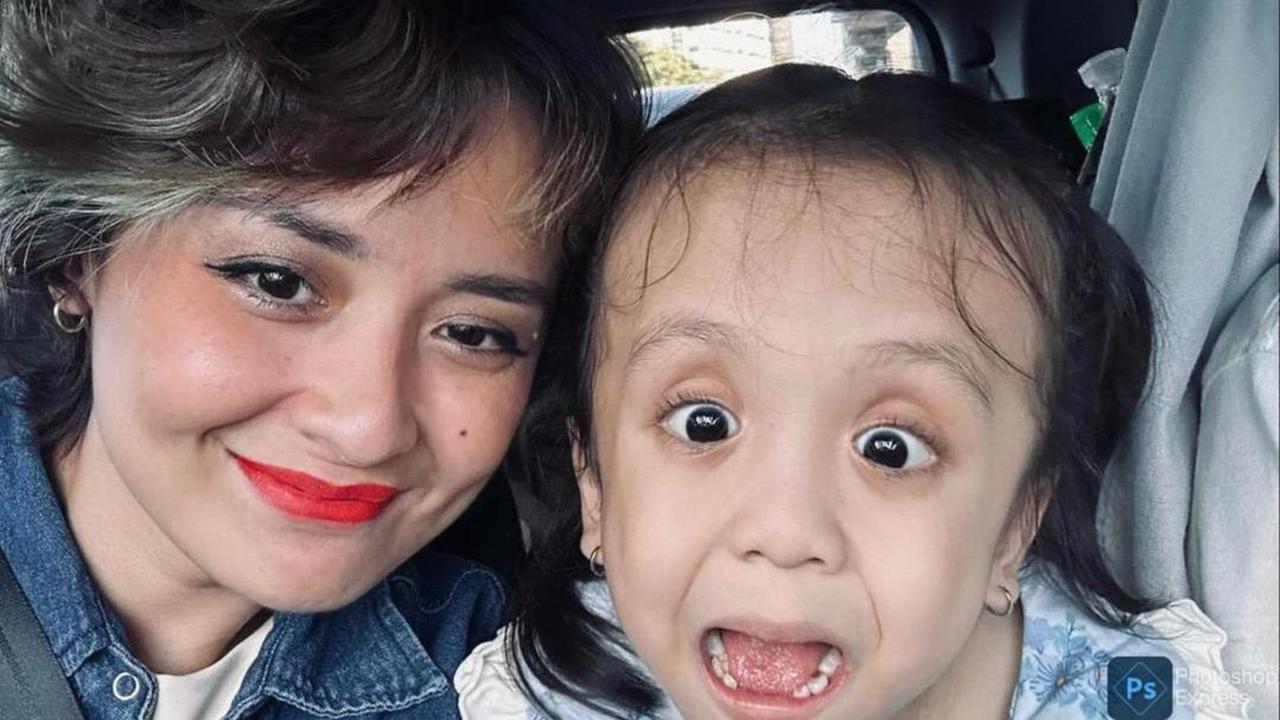 Ziona Anak Joanna Alexandra Dilarikan ke IGD Gara-gara Hidung kemasukan Benda Asing, Sempat Ditolak 3 Rumah Sakit