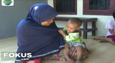 Puluhan balita di Purwakarta, terjangkit Flu Singapura, gejalanya ditandai dengan demam tinggi, kulit gatal-gatal hingga radang tenggorokan.