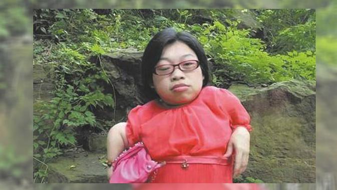 Kisah Haru Wanita dengan Tinggi 89 Cm yang Ingin Menjadi 