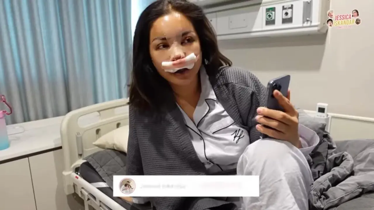 6 Potret Tampilan Terbaru Jessica Iskandar Pasca Oplas Hidung, Menawan dengan Makeup Minimalis