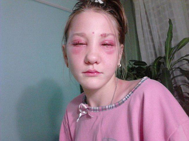 Dampak pewarnaan bulu mata dan alis pada Masha | foto: copyright dailymail.co.uk