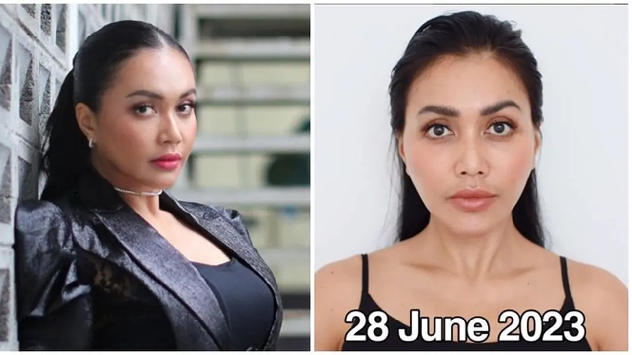 Jalani Operasi Plastik, Ini 7 Potret Terbaru Denada yang Curi Perhatian