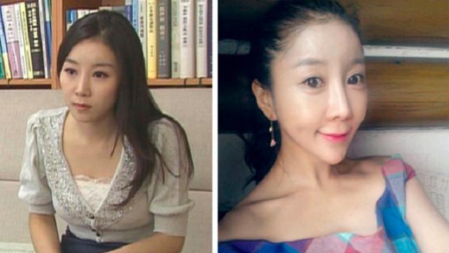 Gara-gara Operasi Plastik, Wajah Reporter Asal Korsel Bikin Kecewa Netizen