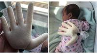 Tangan palsu untuk menenangkan bayi (Sumbe: thepochtime)