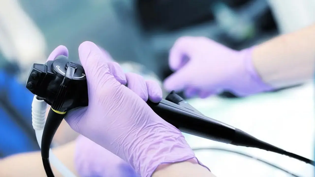 Apakah Semua Pasien GERD Perlu Jalani Prosedur Endoskopi? Health