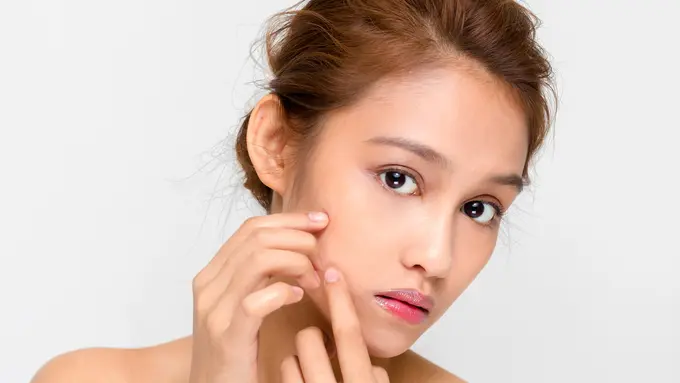 Beauty Tips: Acne Spot Treatment