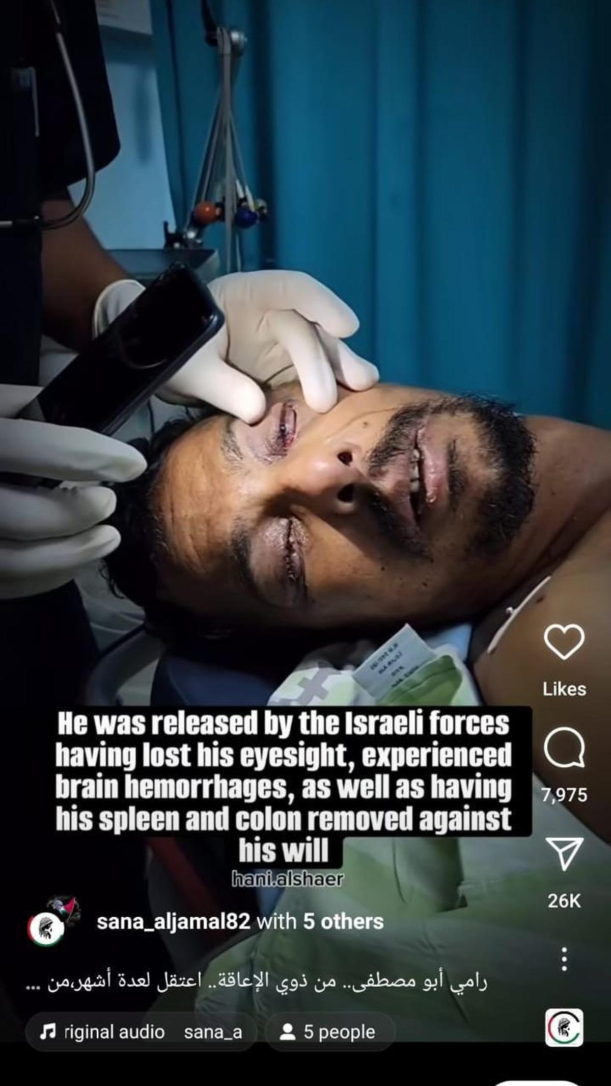 Tuai Kecaman