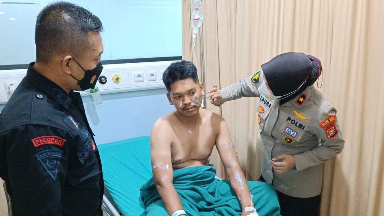 Anggota Brimob Disiram Air Keras saat Bubarkan Tawuran di Bassura Jaktim, Alami Luka Bakar 12 Persen