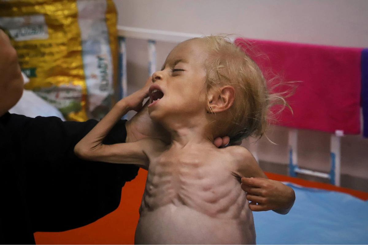 FOTO: Dari Gaza ke Italia, Perjuangan Kecil Shamm Qudeih