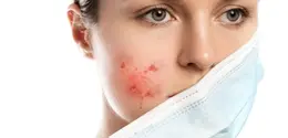 Tidak perlu langsung menambah banyak produk skincare. Rutinitas yang lembut dan kebiasaan menjaga kebersihan masker bisa menjadi langkah awal. (Foto/Dok: Magnific)
