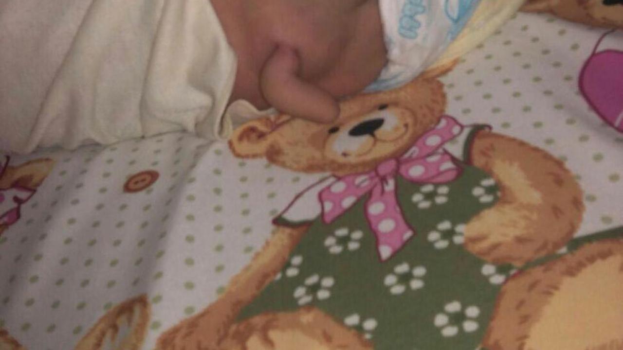 Bayi Mungil Ini memiliki 'Ekor' Sepanjang 7 Sentimeter