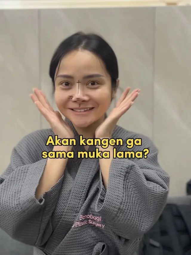 Mawar AFI Oplas Hidun di Korea Korea Selatan