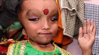 Bocah yang memiliki penyakit langka ini malah dipuja bak dewa oleh penduduk desa karena rupanya yang seperti dewa Ganesha
