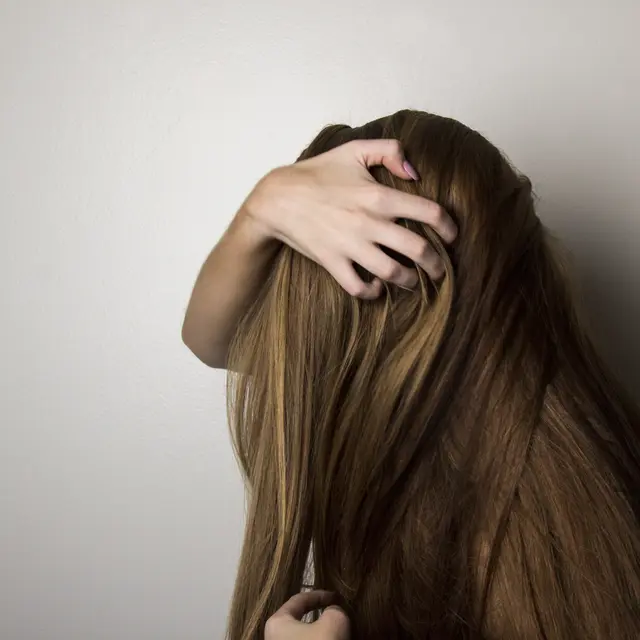 5 Cara Alami Atasi Ketombe Membandel Beauty Fimela Com