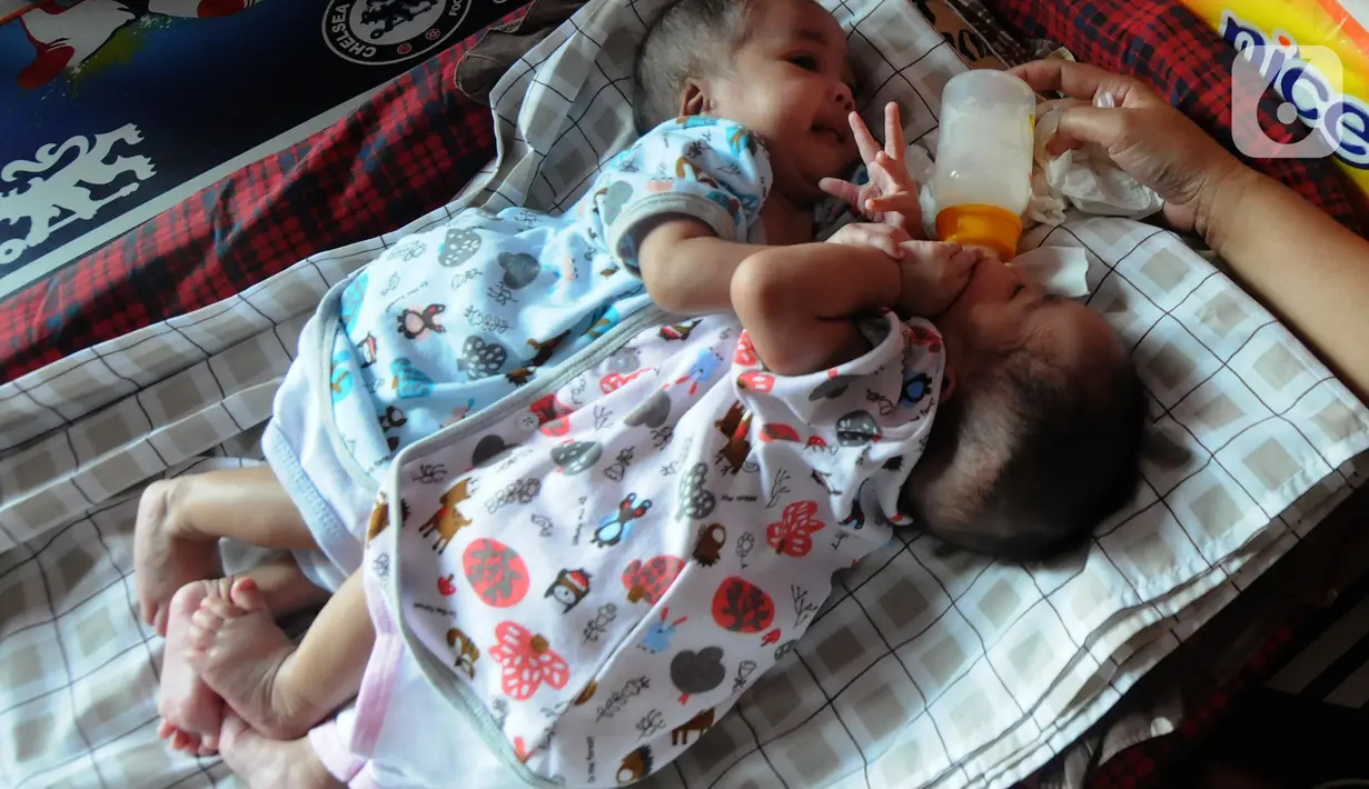 Bayi kembar siam Queenetha Zaina dan Queenesha Zahira di rumahnya di Perumahan Permata Indah Blok W No. 18 RT 18/03, Desa Bojongraharja, Kabupaten Sukabumi, Sabtu (14/08/2021). Bayi kembar siam berusia 1,5 bulan ini memiliki dua jantung dan satu hati. (merdeka.com/Arie Basuki)