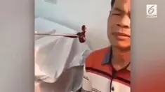 Ngeri! Seorang dokter THT di Cina berhasil mengeluarkan seekor lintah berukuran besar dari lubang hidung Pria berusia 51 tahun.