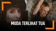 Idap Penyakit Langka, Wanita Muda Ini Terlihat Tua