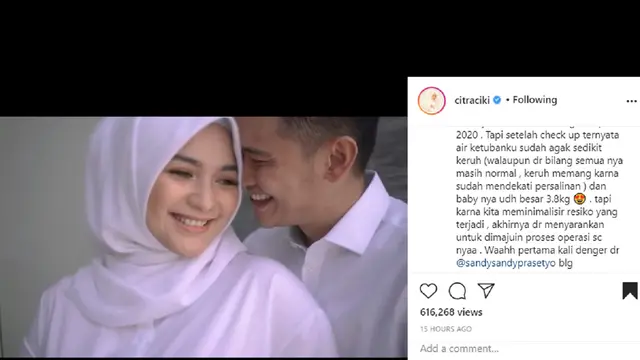 Citra KIrana