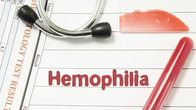 Benarkah Hemofilia Lebih Mudah Menyerang Pria? (Shidlovski/Shutterstock)