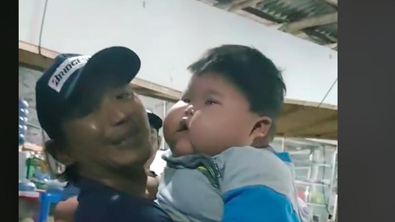 Viral bayi 1 tahun miliki berat badan 25 kg