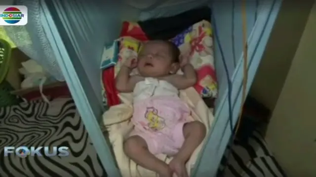 Seorang bayi di Kabupaten Polewali Mandar, Sulawesi Barat, lahir dengan memiliki jenis kelamin ganda atau bahasa latinnya ambigous genital.