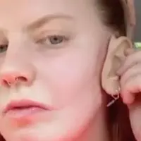 remaja putri yang hanya punya satu telinga/dok. Thelittlethings