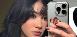Naysilla Mirdad Jalani Mini-Facelift dan Fat Graft. [@naymirdad]
