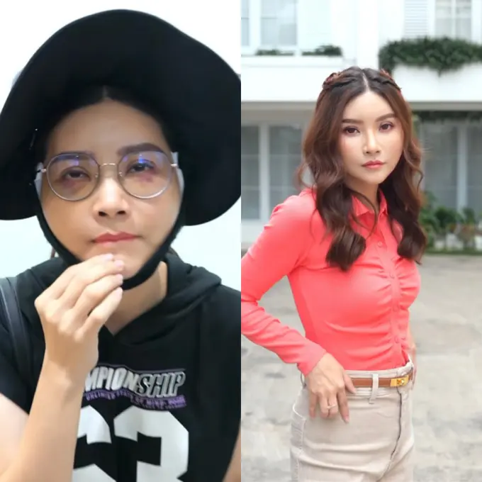 Wajah Sarwendah Setelah 13 Hari Operasi Plastik