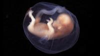 Ilustrasi embrio manusia. (Sumber Flickr/lunar caustic)