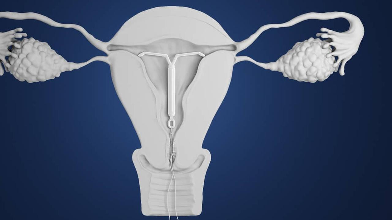 Kenali Rasa Sakit Pemasangan IUD, Berapa Lama dan Bagaimana Cara Meredakannya?