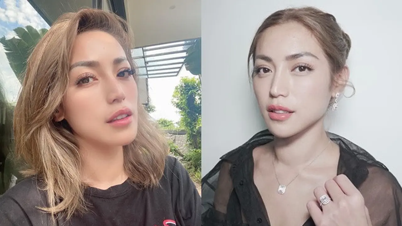 6 Potret Terbaru Jessica Iskandar, Leher Bengkak Akibat Sakit Tiroid