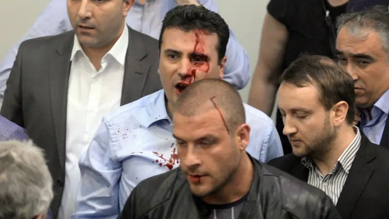 Pemimpin Partai Sosial Demokrat Zoran Zaev yang terluka saat rusuh di Parlemen Macedonia. (AFP)