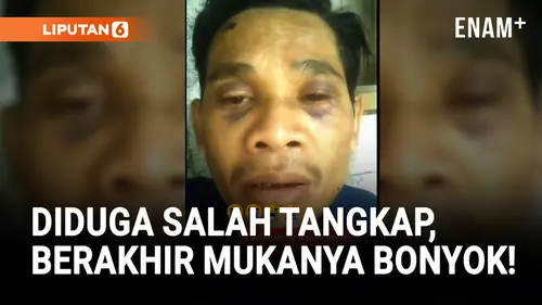 VIDEO: Viral! Diduga Salah Tangkap, Pria di Cianjur Bonyok dan Ngadu ke Dedi Mulyadi!