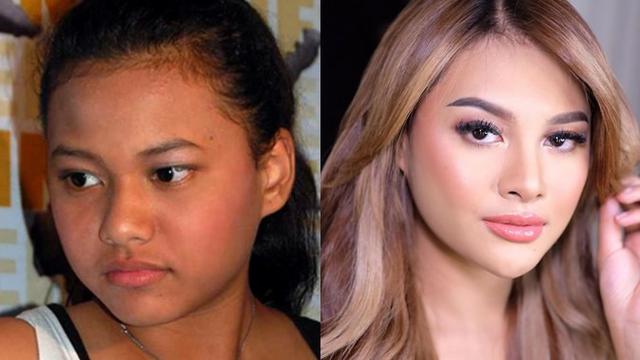 Aurel Hermansya berkarier sejak berumur 12 tahun, dengan merilis album pertamanya, Tanpa Bintang. Kini ia menjadi seleb muda yang memiliki banyak penggemar.