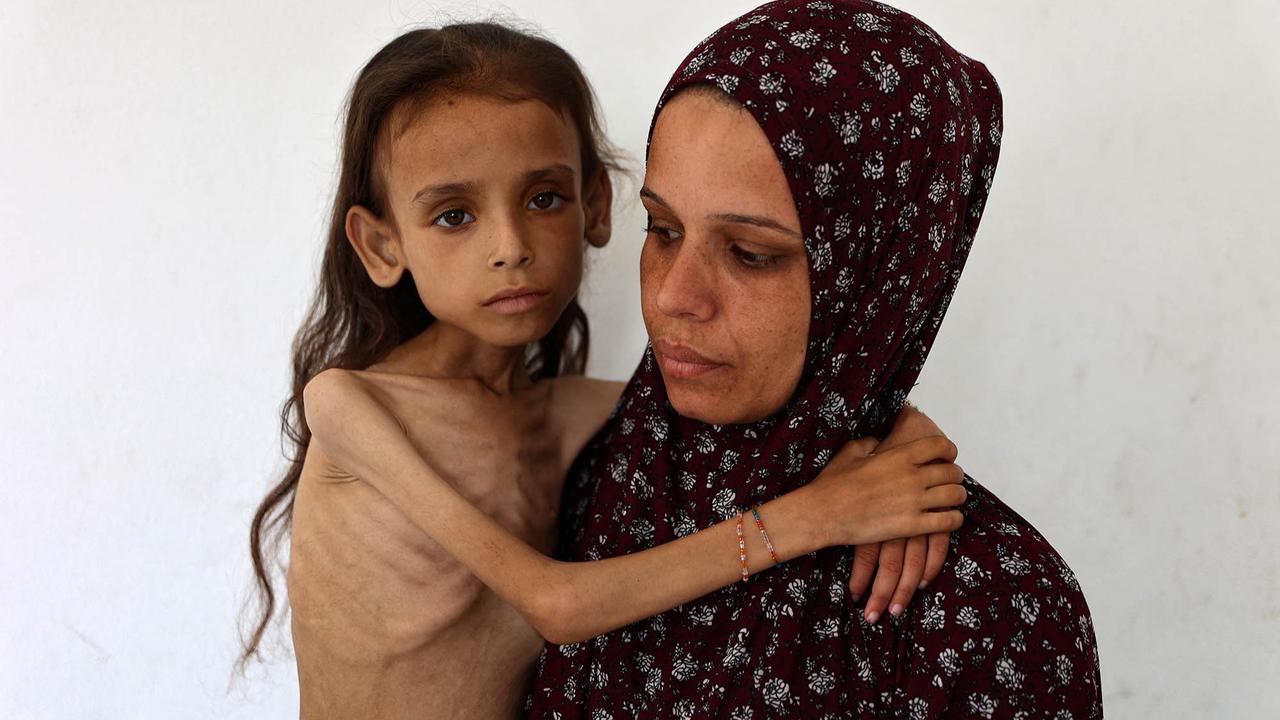 FOTO: Potret Pedih Mariam Anak 9 Tahun, Korban Kelaparan Gaza