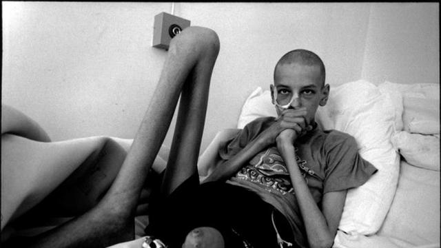 5 Bencana Nuklir Terparah Sepanjang Sejarah