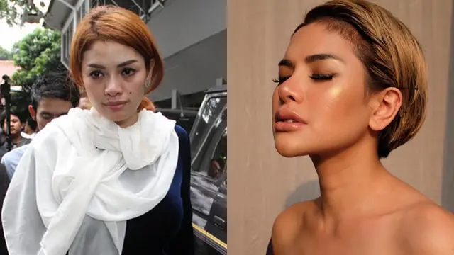 Seleb Ini Lakukan Operasi Hidung, Penampilan Terbaruya Bikin Pangling