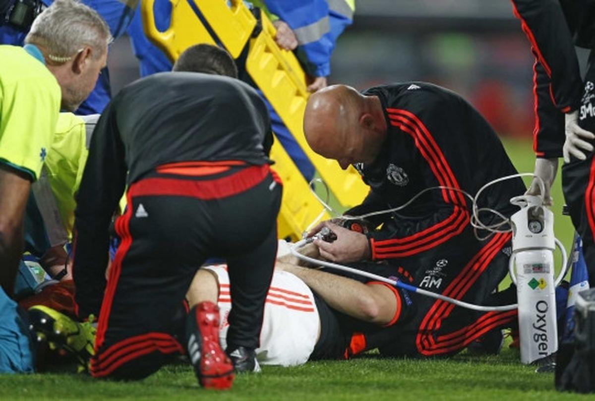 Ini insiden patah kaki Luke Shaw usai dijegal pemain PSV Eindhoven