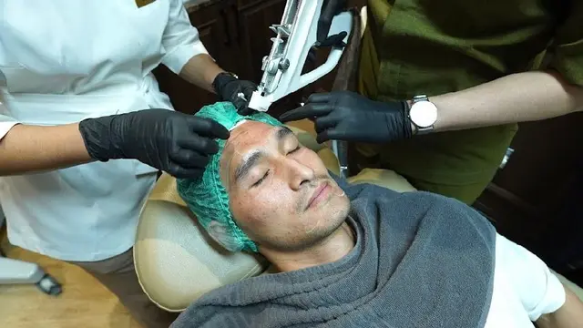 Perawatan Bro-tox Micro Injection untuk pria