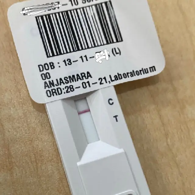 Anjasmara Buktikan Diri Rutin Cek Swab Sebelum Jalani Syuting.