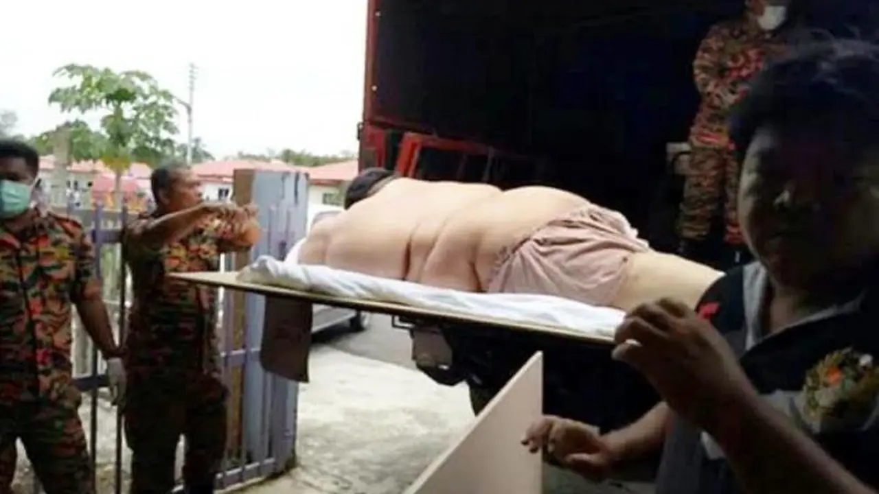 Obesitas