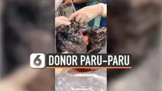 Chen Jingyu, ahli bedah tranplantasi paru-paru dari Rumah Sakit Rakyat Wuxi di Jiangsu, China segera menolak paru-paru yang didonorkan setelah melihat kondisinya. Paru-paru tersebut menghitam, karena berasal dari seorang perokok berat.