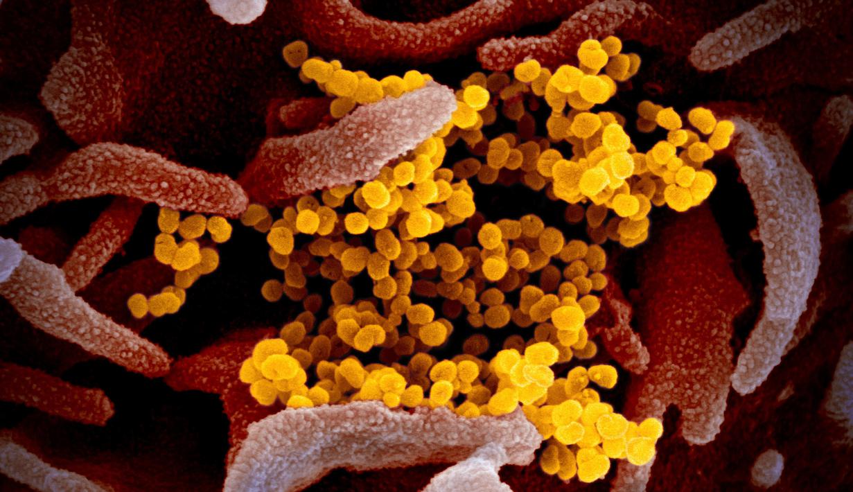 Foto Penampakan Virus Corona Covid 19 Dilihat Dari Mikroskop