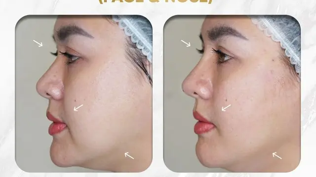 Perubahan wajah pada Vicky Shu