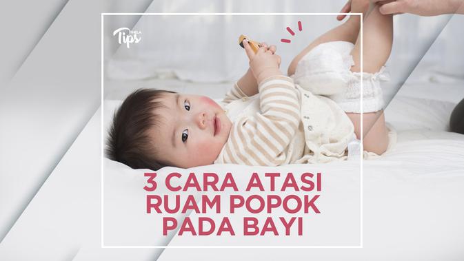 Cara Ampuh Mengatasi Ruam Popok pada Bayi - Lifestyle ...