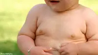 Kunci Cegah Diabetes pada Anak, Jangan Biarkan Gemuk