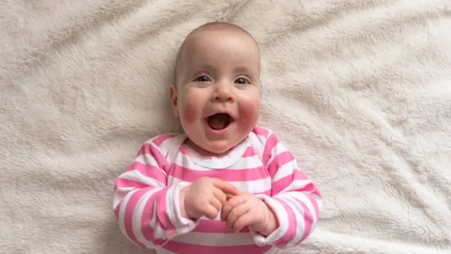 Ilustrasi Bayi Alergi