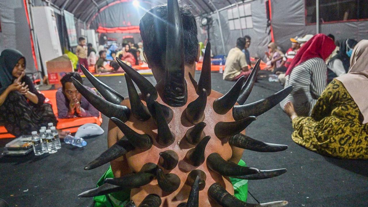 FOTO: Terapi Bekam Tanduk Sapi, Pilihan Pengobatan Lawas di Zaman Modern