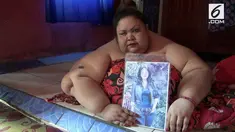 Seorang wanita di Palangkaraya, Kalimantan Tengah mengalami obesitas dan mempunyai berat hingga 300 kg. Kondisi ini membuatnya tak bisa beraktifitas dan butuh bantuan untuk mengecilkan berat badannya.